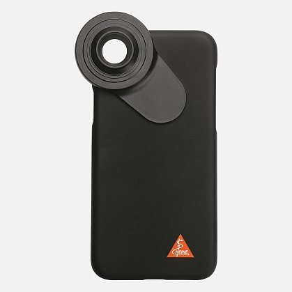 Adapter case for HEINE DELTA 30 / DELTA 30 PRO / DELTAone dermatoscope for iPhone 11 Pro